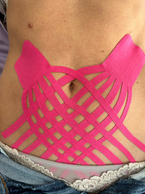 Feel Gynäkologie Taping Kurs (Präsenz)