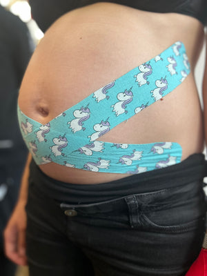 Feel Gynäkologie Taping Kurs (Präsenz)