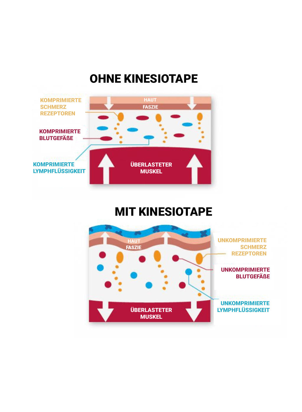 How Kinesiology Tape Works